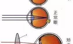 人体工厂视网膜成像攻略